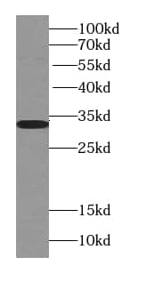 Western Blot: TST Antibody (5E11) [NBP3-43056] - rat brain tissue were subjected to SDS PAGE followed by western blot with (TST Antibody) at dilution of 1:1000