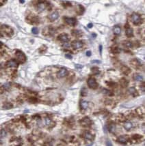 Immunohistochemistry: TST Antibody (5E11) [NBP3-43056] - Immunohistochemistry of paraffin-embedded human liver using (TST antibody) at dilution of 1:50