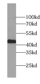 Western Blot: RNA polymerase I termination factor Antibody (4D3) [NBP3-43057] - HeLa cells were subjected to SDS PAGE followed by western blot with (RNA polymerase I termination factor antibody) at dilution of 1:1000