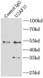 Immunoprecipitation: U2AF35 Antibody (1E9) [NBP3-43059] - IP Result of anti-U2AF35 (IP:FNab09138, 3ug; Detection:FNab09138 1:500) with HeLa cells lysate 3000ug.