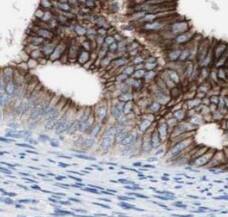 Immunohistochemistry: USP1 Antibody (8F7) [NBP3-43060] - Immunohistochemistry of paraffin-embedded human cervical cancer using (USP1 antibody) at dilution of 1:50