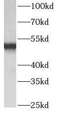 Western Blot: ATPB Antibody (5B3) [NBP3-43063] - Hela cells were subjected to SDS PAGE followed by western blot with (ATPB antibody) at dilution of 1:10000