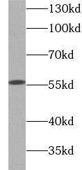 Western Blot: Glucose 6 phosphate isomerase Antibody (4F11) [NBP3-43065] - HeLa cells were subjected to SDS PAGE followed by western blot with (Glucose 6 phosphate isomerase antibody) at dilution of 1:5000