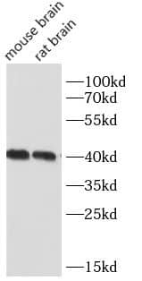 Western Blot: NDRG2 Antibody (4H3) [NBP3-43066] - Various lysates were subjected to SDS PAGE followed by western blot with (NDRG2 Antibody) at dilution of 1:5000.