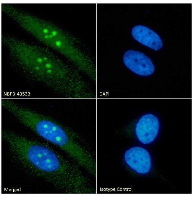 Immunocytochemistry/ Immunofluorescence: RRM2 Antibody (SAIC-30E-7) - Chimeric - BSA Free [NBP3-43533] - Immunofluorescence analysis of paraformaldehyde fixed HeLa cells permeabilized with 0.15% Triton stained with NBP3-43533 (1:100 dilution) for 1h followed by Alexa Fluor® 488 secondary antibody (1:1000 dilution), showing nucleoli staining. The nuclear stain is DAPI (blue). Panels show from left-right, top-bottom NBP3-43533, DAPI, merged channels and an isotype control. The isotype control was an unknown specificity antibody followed by staining with Alexa Fluor® 488 secondary antibody.