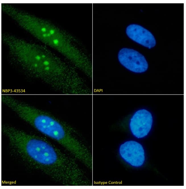 Immunocytochemistry /Immunofluorescence: RRM2 Antibody (SAIC-30E-7) - BSA Free [NBP3-43534] - Immunofluorescence analysis of paraformaldehyde fixed HeLa cells permeabilized with 0.15% Triton stained with NBP3-43534 (1:100 dilution) for 1h followed by Alexa Fluor 488 secondary antibody (1:1000 dilution), showing nucleoli staining. The nuclear stain is DAPI (blue). Panels show from left-right, top-bottom NBP3-43534, DAPI, merged channels and an isotype control. The isotype control was an unknown specificity antibody followed by staining with Alexa Fluor 488 secondary antibody.