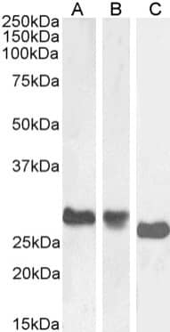 Western Blot: MHC Class II Antibody (OX-6) - BSA Free [NBP3-43538] - Rat spleen (A), rat thymus (B) and rat lymph node (C) lysate samples (35µg protein in RIPA buffer) were resolved on a 10% SDS PAGE gel and blots probed with NBP3-43538 at 1 µg/ml before detection using an anti-rabbit secondary antibody. A primary incubation of 1h was used and protein was detected by chemiluminescence. The expected running size for MHC Class II is ~24.5-31.6kDa, depending on the isoform and post-translational modification. NBP3-43538 successfully detected MHC Class II in rat spleen, thymus and lymph node lysates.