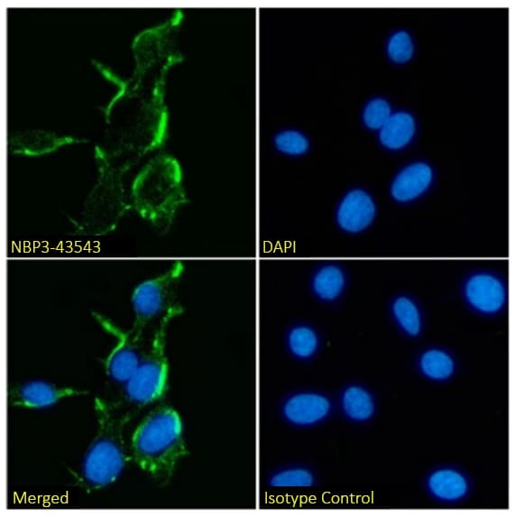 Immunocytochemistry/ Immunofluorescence: NMDAR2B Antibody (17) - BSA Free [NBP3-43543] - Immunofluorescence analysis of paraformaldehyde fixed C6 cells stained with NBP3-43543 at 10 µg/ml for 1h followed by Alexa Fluor® 488 secondary antibody (2 µg/ml), showing membrane staining. The nuclear stain is DAPI (blue). Panels show from left-right, top-bottom NBP3-43543, DAPI, merged channels and an isotype control. The isotype control was an unknown specificity antibody followed by staining with Alexa Fluor® 488 secondary antibody.