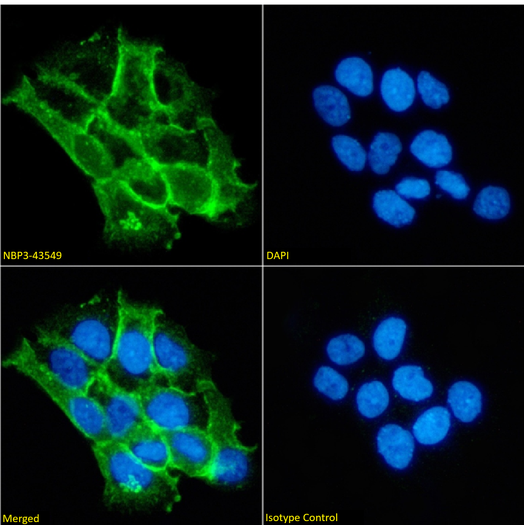 Immunocytochemistry /Immunofluorescence: Catenin alpha 1 Antibody (1G5) - Chimeric - BSA Free [NBP3-43549] - Immunofluorescence analysis of paraformaldehyde fixed A431 cells on Shi-fix coverslips stained with NBP3-43549 at 10 ug/ml for 1h followed by Alexa Fluor 488 secondary antibody (2 ug/ml), showing membrane staining. The nuclear stain is DAPI (blue). Panels show from left-right, top-bottom NBP3-43549, DAPI, merged channels and an isotype control. The isotype control was an unknown specificity antibody followed by staining with Alexa Fluor 488 secondary antibody.