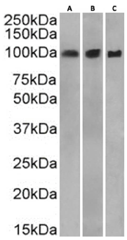 Western Blot: Catenin alpha 1 Antibody (1G5) - Chimeric - BSA Free [NBP3-43549] - A431(A) (0.003ug/ml), HeLa(B) (0.03ug/ml) and MCF7(C) (0.01ug/ml) cell lysate. (35ug protein in RIPA buffer) was resolved on a SDS PAGE gel and blots were probed with NBP3-43549 before detection using an anti-rabbit secondary antibody. A primary incubation of 1h was used and protein was detected by chemiluminescence.