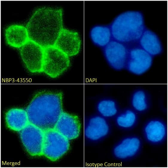 Immunocytochemistry/ Immunofluorescence: TCR alpha/beta Antibody (BMA031) - Chimeric - BSA Free [NBP3-43550] - Immunofluorescence analysis of paraformaldehyde-fixed Jurkat cells on coverslips stained with NBP3-43550 (1:100 dilution) for 1h followed by Alexa Fluor® 488 secondary antibody (1:1000 dilution), showing membrane staining. The nuclear stain is DAPI (blue). Panels show, from left-right, top-bottom, NBP3-43550, DAPI, merged channels and an isotype control. The isotype control was an unknown specificity antibody followed by staining with Alexa Fluor® 488 secondary antibody.