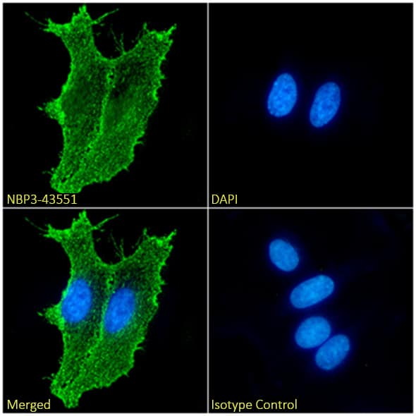 Immunocytochemistry/ Immunofluorescence: Ganglioside GD2 Antibody (14G2a) - Chimeric - BSA Free [NBP3-43551] - Immunofluorescence analysis of paraformaldehyde fixed Kelly cells on coverslips stained with NBP3-43551 (1:100 dilution) for 1h followed by Alexa Fluor® 488 secondary antibody (1:1000 dilution), showing membrane staining. The nuclear stain is DAPI (blue). Panels show, from left-right, top-bottom, NBP3-43551, DAPI, merged channels and an isotype control. The isotype control was an unknown specificity antibody followed by staining with Alexa Fluor® 488 secondary antibody.