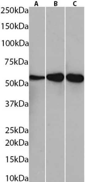 Western Blot: Fibrin beta-chain Antibody (59D8) - BSA Free [NBP3-43554] - Human liver (A), placenta (B), and serum (C) tissue lysates (35µg protein in RIPA buffer) were resolved via SDS-PAGE, and the subsequent blots were probed with NBP3-43554 at 0.01µg/ml before detection using an anti-rabbit secondary antibody. A primary incubation of 1 hour was used, and proteins were detected by chemiluminescence.