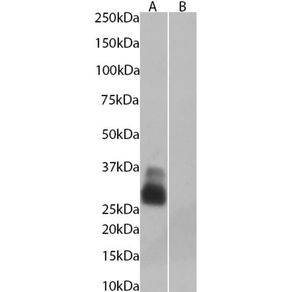 Western Blot: Aquaporin-4 Antibody (C9401) - Chimeric - BSA Free [NBP3-43559] - Unboiled (A) and boiled (B) human skeletal muscle tissue lysates (35ug protein in RIPA buffer) were resolved via SDS-PAGE, and the subsequent blots were probed with NBP3-43559 at 0.3ug/ml before detection using an anti-rabbit secondary antibody. A primary incubation of 1 hour was used, and proteins were detected by chemiluminescence.