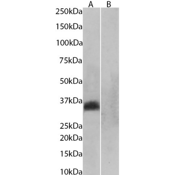 Western Blot: Aquaporin-4 Antibody (D15107) - Chimeric - BSA Free [NBP3-43560] - Unboiled (A) and boiled (B) mouse skeletal muscle tissue lysates (35ug protein in RIPA buffer) were resolved via SDS-PAGE, and the subsequent blots were probed with NBP3-43560 at 1ug/ml before detection using an anti-rabbit secondary antibody. A primary incubation of 1 hour was used, and proteins were detected by chemiluminescence.