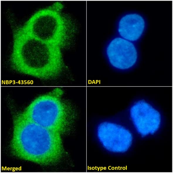 Immunocytochemistry /Immunofluorescence: Aquaporin-4 Antibody (D15107) - Chimeric - BSA Free [NBP3-43560] - Immunofluorescence analysis of paraformaldehyde fixed A431 cells on Shi-fix coverslips stained with NBP3-43560 (1:100 dilution) for 1h followed by Alexa Fluor 488 secondary antibody (1:1000 dilution), showing cytoplasmic staining. The nuclear stain is DAPI (blue). Panels show, from left-right, top-bottom: NBP3-43560, DAPI, merged channels, and an isotype control. The isotype control was an unknown specificity antibody followed by staining with Alexa Fluor 488 secondary antibody.