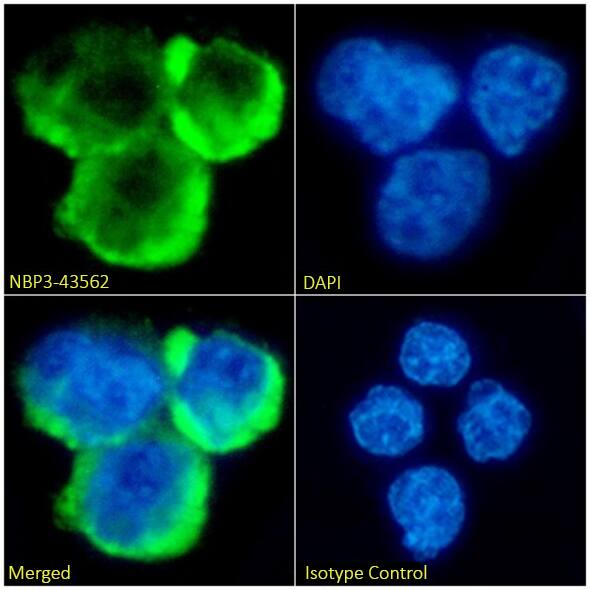 Immunocytochemistry/ Immunofluorescence: CENPE Antibody (CA8) - BSA Free [NBP3-43561] - Immunofluorescence analysis of paraformaldehyde fixed Daudi cells on coverslips stained with the chimeric version of this antibody, NBP3-43562 (1:100 dilution),  for 1h followed by Alexa Fluor® 488 secondary antibody (1:1000 dilution), showing membrane and cytoplasmic staining. The nuclear stain is DAPI (blue). Panels show, from left-right, top-bottom, NBP3-43562, DAPI, merged channels, and an isotype control. The isotype control was an unknown specificity antibody followed by staining with Alexa Fluor® 488 secondary antibody.