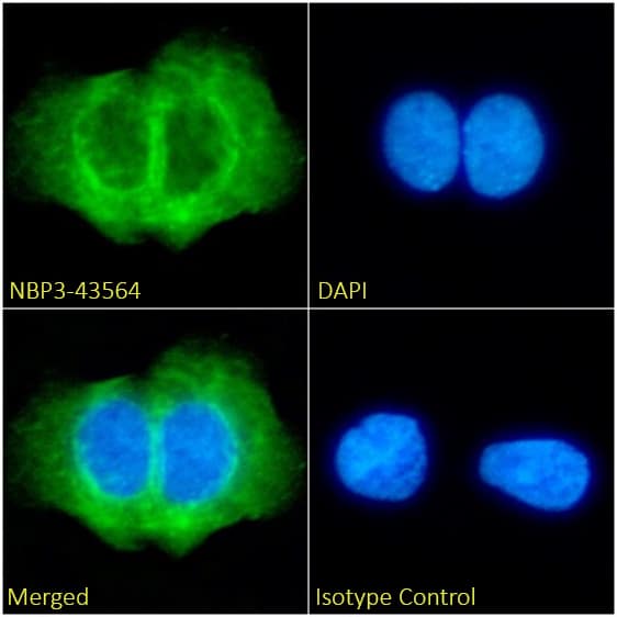 Immunocytochemistry/ Immunofluorescence: Cytokeratin 5/6 Antibody (AbM58019-7H4) - Chimeric - BSA Free [NBP3-43564] - Immunofluorescence analysis of paraformaldehyde-fixed A431 cells, permeabilized with 0.15% Triton, on coverslips stained with NBP3-43564 (1:100 dilution) for 1h followed by Alexa Fluor® 488 secondary antibody (1:1000 dilution), showing cytoplasmic staining. The nuclear stain is DAPI (blue). Panels show, from left-right, top-bottom, NBP3-43564, DAPI, merged channels, and an isotype control. The isotype control was an unknown specificity antibody followed by staining with Alexa Fluor® 488 secondary antibody.