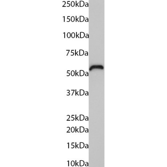 Western Blot: Cytokeratin 5/6 Antibody (AbM58019-7H4) - Chimeric - BSA Free [NBP3-43564] - A431 cells lysate (35µg protein in RIPA buffer) was resolved via SDS-PAGE, and the subsequent blot was probed with the mouse version of NBP3-43564 at 0.01µg/ml before detection using an anti-mouse secondary antibody. A primary incubation of 1 hour was used, and proteins were detected by chemiluminescence.