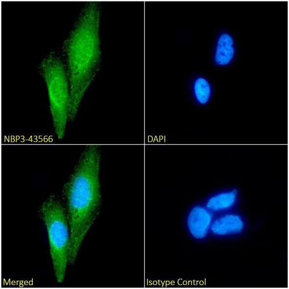 Immunocytochemistry/ Immunofluorescence: Cytokeratin 20 Antibody (10F6B12A9) - BSA Free [NBP3-43566] - Immunofluorescence analysis of paraformaldehyde-fixed Caco-2 cells, permeabilized with 0.15% Triton, on coverslips stained with NBP3-43566 (1:100 dilution) for 1 hour followed by Alexa Fluor® 488 secondary antibody (1:1000 dilution), showing cytoplasmic and some nuclear staining. The nuclear stain is DAPI (blue). Panels show, from left to right, top to bottom, NBP3-43566, DAPI, merged channels, and an isotype control. The isotype control was an unknown specificity antibody followed by staining with Alexa Fluor® 488 secondary antibody.