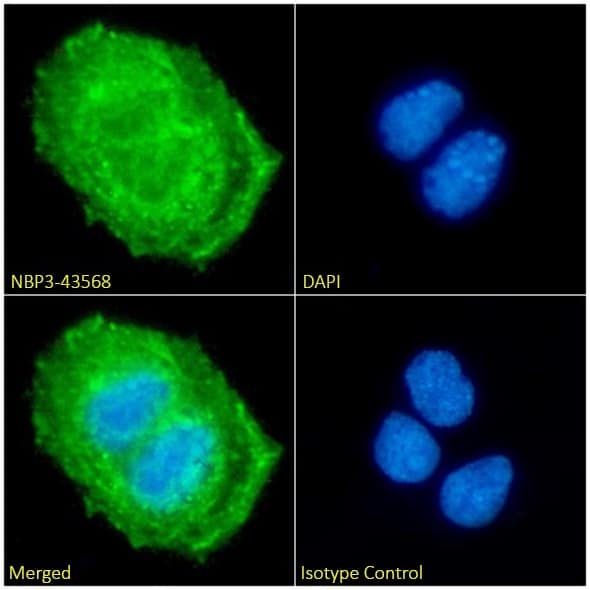 Immunocytochemistry/ Immunofluorescence: Cytokeratin 20 Antibody (10A2) - Chimeric - BSA Free [NBP3-43568] - Immunofluorescence analysis of paraformaldehyde fixed Caco-2 cells, permeabilized with 0.15% Triton, on coverslips stained with NBP3-43568 (1:100 dilution) for 1h followed by Alexa Fluor® 488 secondary antibody (1:1000 dilution), showing cytoplasmic staining. The nuclear stain is DAPI (blue). Panels show, from left-right, top-bottom, NBP3-43568, DAPI, merged channels, and an isotype control. The isotype control was an unknown specificity antibody followed by staining with Alexa Fluor® 488 secondary antibody.
