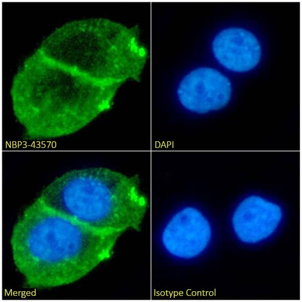 Immunocytochemistry/ Immunofluorescence: Beta Dystroglycan Antibody (P38G1) - Chimeric - BSA Free [NBP3-43570] - Immunofluorescence analysis of paraformaldehyde fixed A431 cells on coverslips stained with NBP3-43570 (1:100 dilution) for 1h followed by Alexa Fluor® 488 secondary antibody (1:1000 dilution), showing cell membrane/junction and cytoplasmic staining. The nuclear stain is DAPI (blue). Panels show, from left-right, top-bottom, NBP3-43570, DAPI, merged channels, and an isotype control. The isotype control was an unknown specificity antibody followed by staining with Alexa Fluor® 488 secondary antibody.