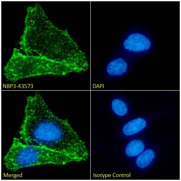 Immunocytochemistry/ Immunofluorescence: Nicotinic Acetylcholine Receptor beta 2 Antibody (12H2) - BSA Free [NBP3-43572] - Immunofluorescence analysis of paraformaldehyde fixed Kelly cells on coverslips stained with the chimeric version of this antibody, NBP3-43573 (1:100 dilution) for 1h followed by Alexa Fluor® 488 secondary antibody (1:1000 dilution), showing membrane staining. The nuclear stain is DAPI (blue). Panels show, from left-right, top-bottom, NBP3-43573, DAPI, merged channels, and an isotype control. The isotype control was an unknown specificity antibody followed by staining with Alexa Fluor® 488 secondary antibody.