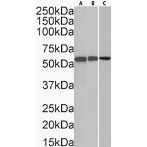 Western Blot: TdT Antibody (32D5) - Chimeric - BSA Free [NBP3-43576] - Jurkat (A) (0.03µg/ml) and Molt-4 (B) (0.03µg/ml) cells lysates, and Jurkat (C) (0.01µg/ml) cells nuclear lysate (35µg protein in RIPA buffer) were resolved on an SDS-PAGE gel, and blots were probed with NBP3-43576 at the mentioned respective concentrations before detection using an anti-rabbit secondary antibody. A primary incubation of 1 hour was used, and protein was detected by chemiluminescence.