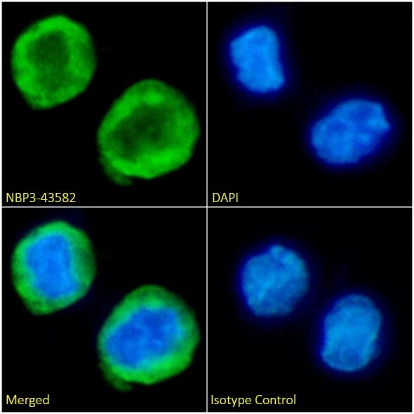 Immunocytochemistry/ Immunofluorescence: KRAS Antibody (D113) - Mutant - BSA Free [NBP3-43582] - Immunofluorescence analysis of paraformaldehyde fixed THP-1 cells on coverslips stained with the chimeric version of this antibody, NBP3-43583 (1:100 dilution) for 1h followed by Alexa Fluor® 488 secondary antibody (1:1000 dilution), showing membrane and cytoplasmic staining. The nuclear stain is DAPI (blue). Panels show, from left-right, top-bottom, NBP3-43583, DAPI, merged channels and an isotype control. The isotype control was an unknown specificity antibody followed by staining with Alexa Fluor® 488 secondary antibody.