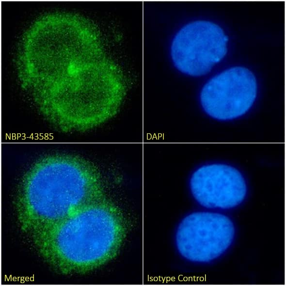 Immunocytochemistry/ Immunofluorescence: Ferritin mitochondrial Antibody (AMB8LK) - BSA Free [NBP3-43585] - Immunofluorescence analysis of paraformaldehyde fixed MCF7 cells, permeabilized with 0.15% Triton, on coverslips stained with the chimeric version of this antibody, NBP3-43586 (1:100 dilution) for 1h followed by Alexa Fluor® 488 secondary antibody (1:1000 dilution), showing cytoplasmic/mitochondrial staining. The nuclear stain is DAPI (blue). Panels show, from left-right, top-bottom, NBP3-43586, DAPI, merged channels, and an isotype control. The isotype control was an unknown specificity antibody followed by staining with Alexa Fluor® 488 secondary antibody.
