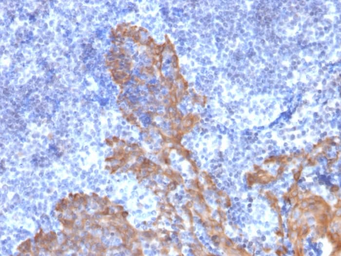 Formalin-fixed, paraffin-embedded human Tonsil stained with Cytokeratin 5/6 Antibody (KRT5.6/2090).