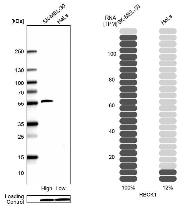 Analysis in human cell lines SK-MEL-30 and HeLa using RBCK1 antibody. Corresponding RBCK1 RNA-seq data are presented for the same cell lines. Loading control: Anti-GAPDH.