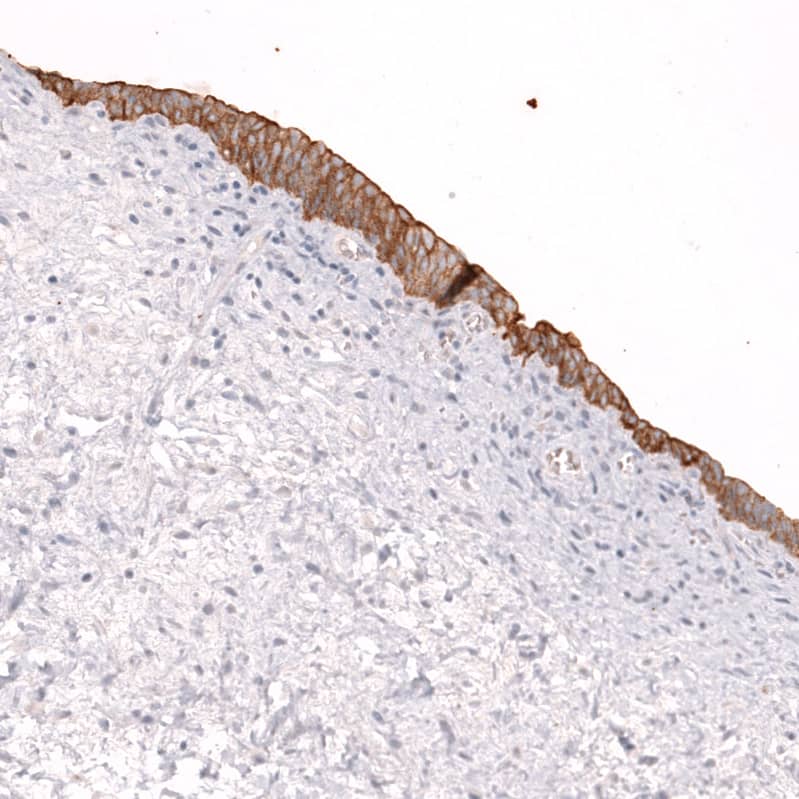 Staining of human urinary bladder shows moderate membranous positivity in urothelial cells.