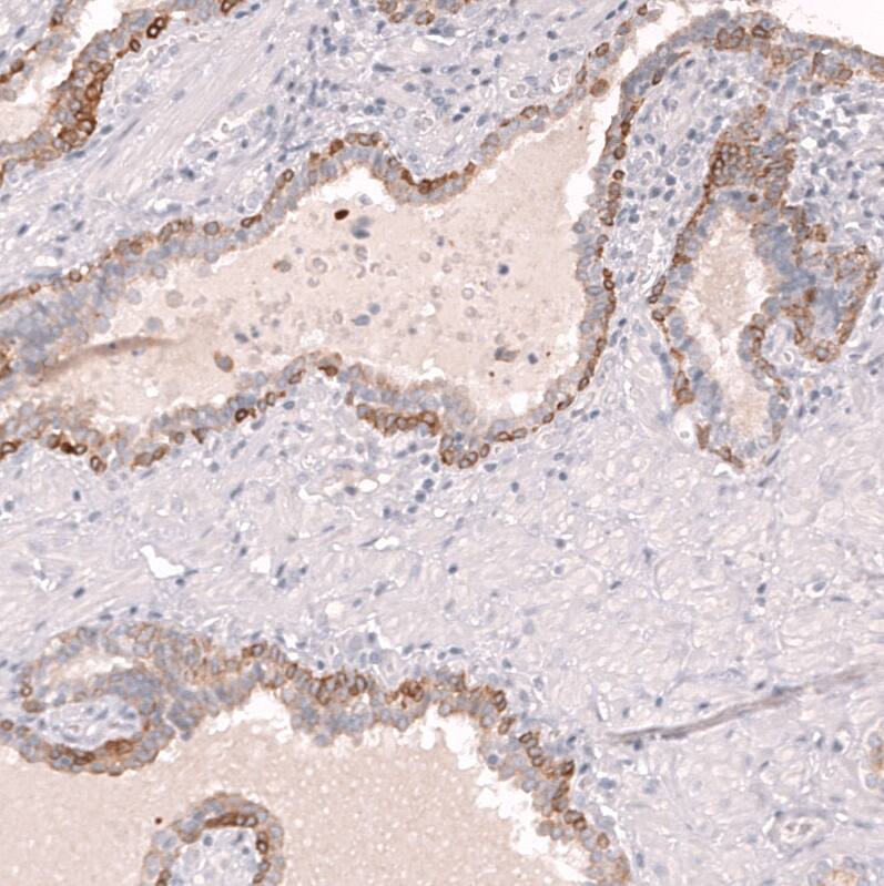 Staining of human prostate shows moderate membranous positivity in the basal layer of glandular cells.