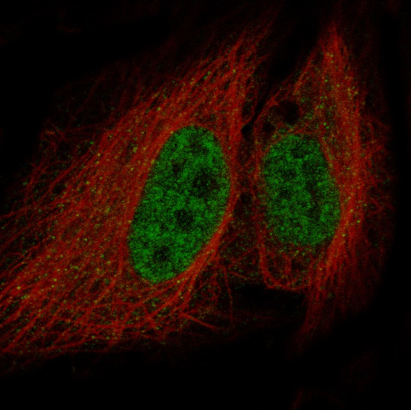 Staining in HeLa cell line with LHX9 monoclonal antibody, showing specific staining of nucleoplasm and vesicles in green. Microtubule- and nuclear probes are visualized in red and blue respectively (where available).