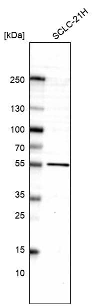 Analysis in human cell line SCLC-21H.