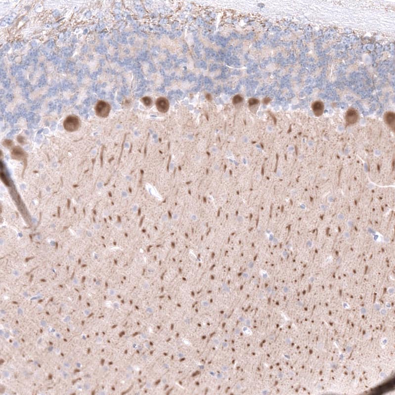 <b>Orthogonal Strategies Validation. </b>Staining of mouse cerebellum shows moderate cytoplasmic positivity in Purkinje cells.