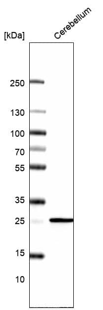 Analysis in human cerebellum tissue.