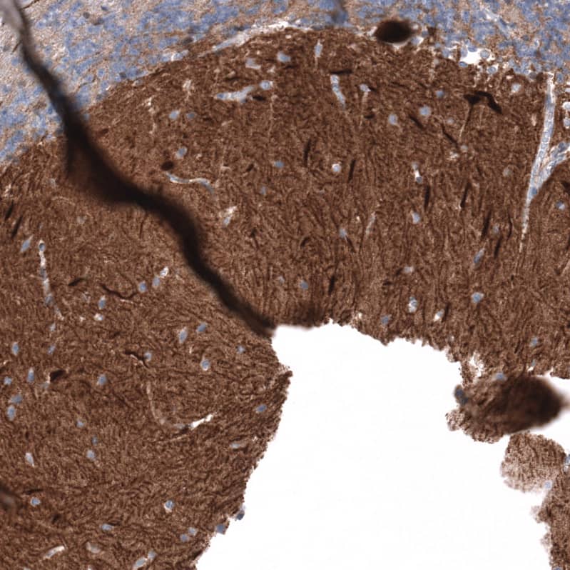 Staining of human cerebellum shows strong cytoplasmic positivity in Purkinje cells.