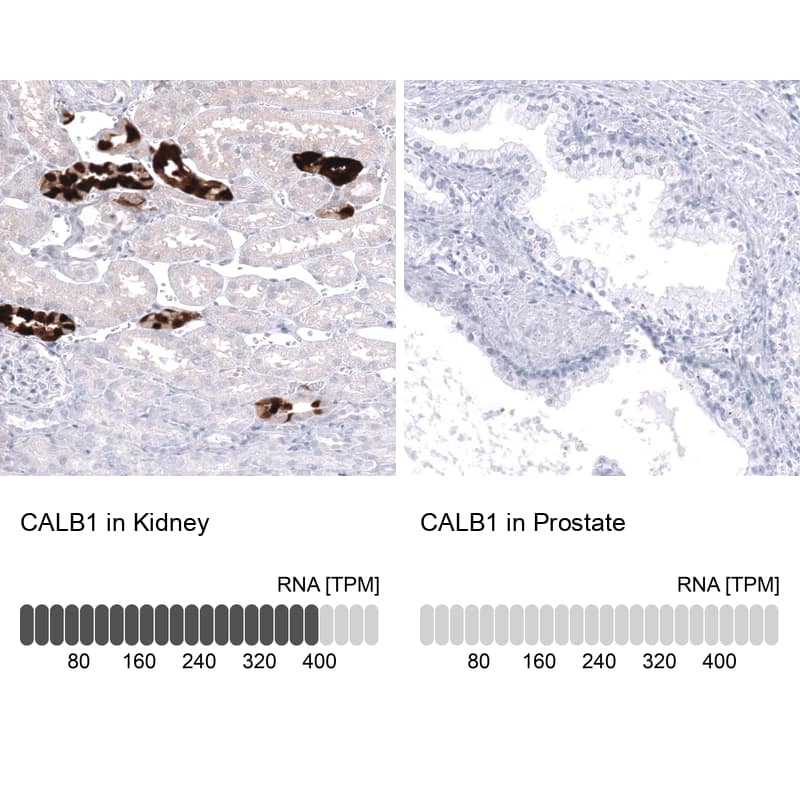 Analysis in human kidney and prostate tissues using NBP3-43645 antibody. Corresponding CALB1 RNA-seq data are presented for the same tissues.