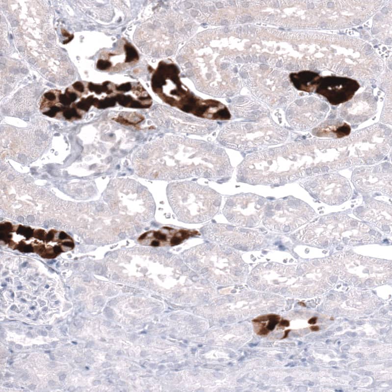 Staining of human kidney shows strong cytoplasmic positivity in cells in tubules.