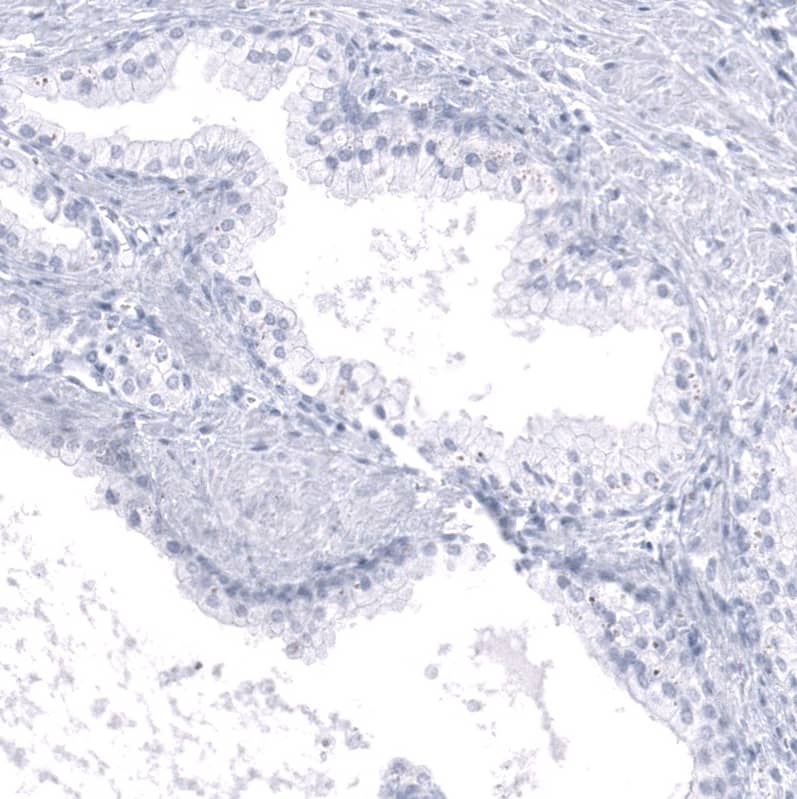 Staining of human prostate shows no positivity in glandular cells as expected.