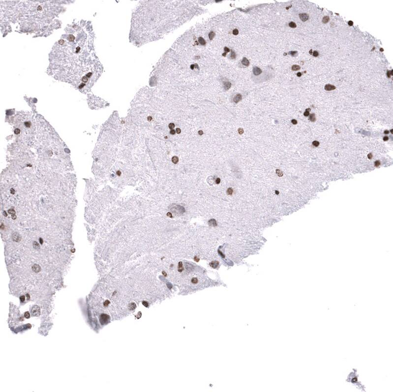 Staining of human cerebral cortex shows moderate to strong nuclear positivity in neurons and glial cells.