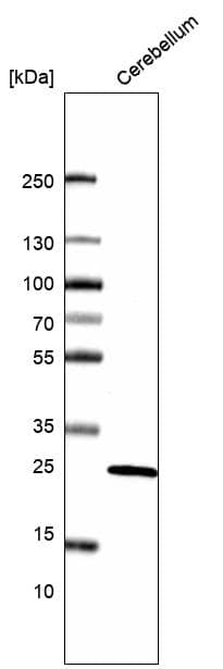 Analysis in human cerebellum tissue.