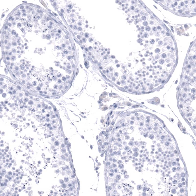 Staining of human testis shows no positivity in cells in seminiferous ducts as expected.