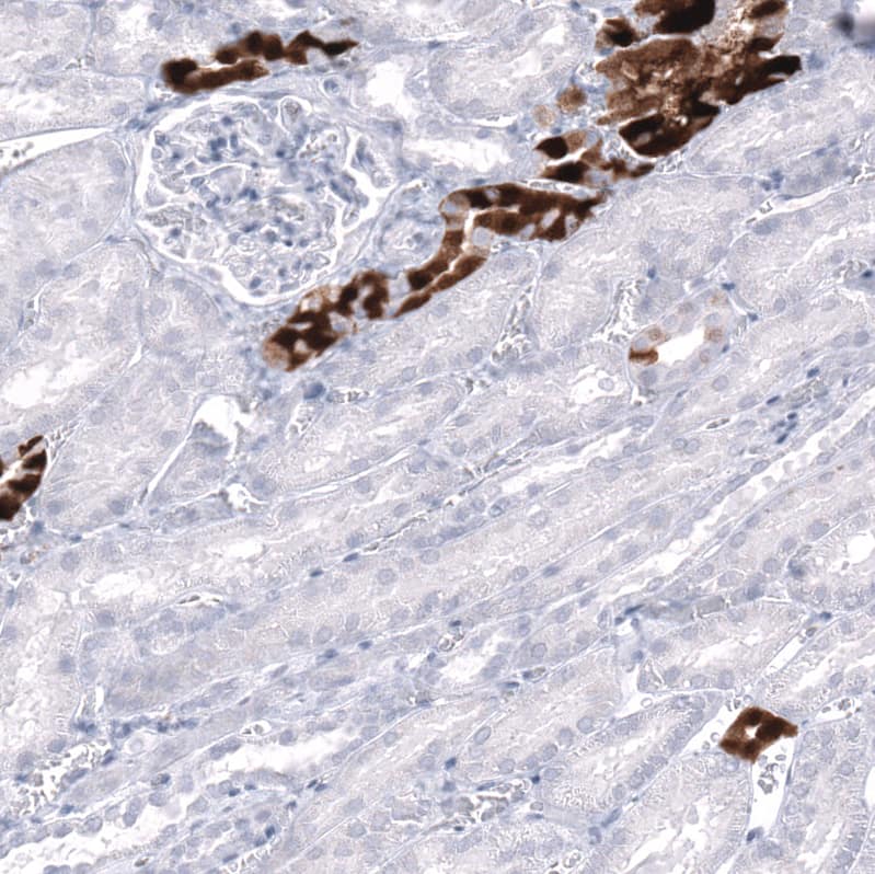 Staining of human kidney shows strong cytoplasmic-membranous positivity in cells in tubules.