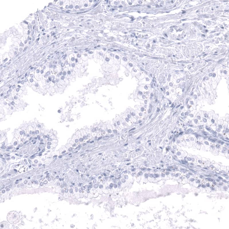 Staining of human prostate shows no positivity in glandular cells as expected.