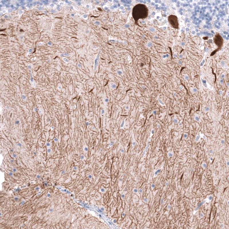 Staining of human cerebellum shows strong cytoplasmic positivity in Purkinje cells.