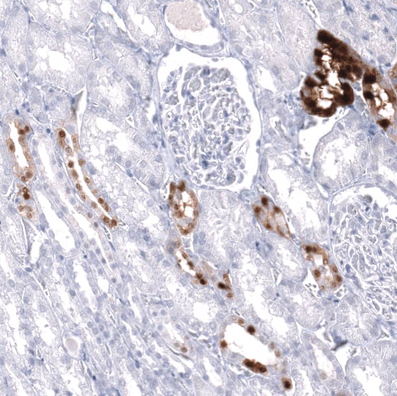 Staining of human kidney shows strong cytoplasmic positivity in cells in tubules.