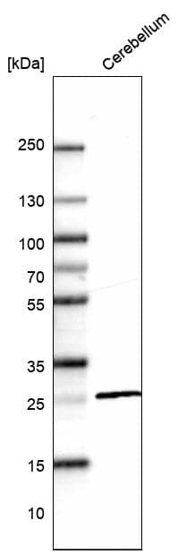 Analysis in human cerebellum tissue.